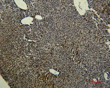 Immunohistochemistry of paraffin-embedded Rat liver tissue using Transferrin Monoclonal Antibody at dilution of 1:50.