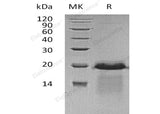 Recombinant Human APBA3 Protein (His Tag) - ABMIUM