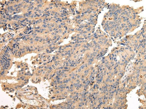 Anti-Human/Mouse/Rat SDCBP Antibody - ABMIUM