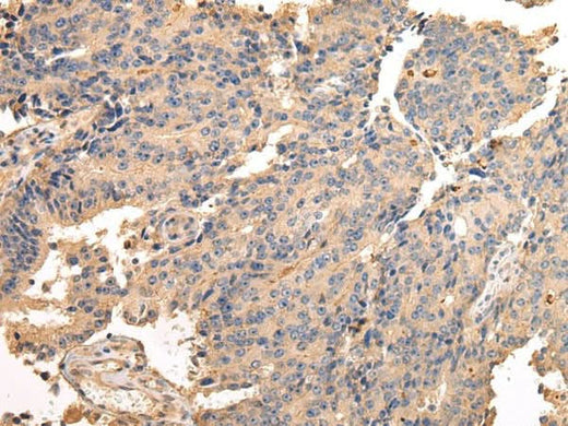 Anti-Human/Mouse/Rat SDCBP Antibody - ABMIUM