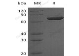 Recombinant Human LCP2 Protein (His Tag, N-T7 Tag) - ABMIUM