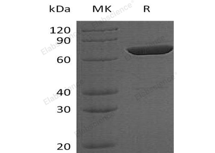Recombinant Human LCP2 Protein (His Tag, N-T7 Tag) - ABMIUM