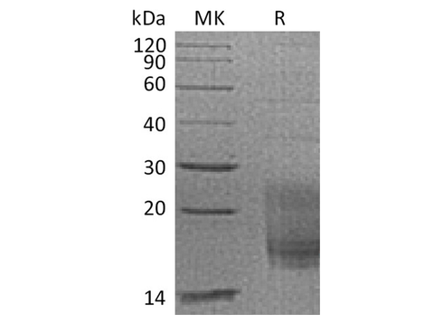 Recombinant Cynomolgus TIGIT/VSIG9/VSTM3 Protein (His Tag) - ABMIUM