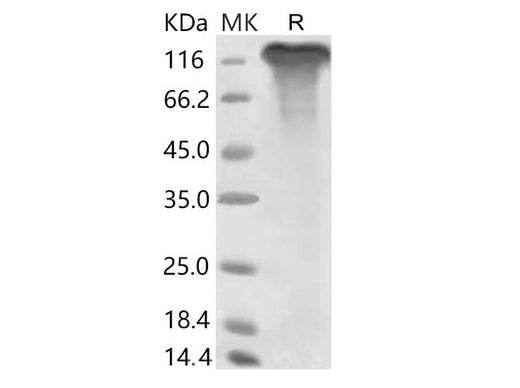 > 85 % as determined by reducing SDS-PAGE.