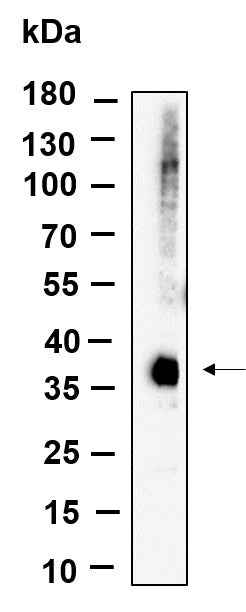Anti-Human/Mouse/Rat eIF2α Antibody [B927] - ABMIUM