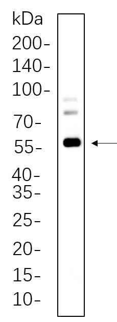 Anti-Human/Mouse/Rat c-Fos Antibody [B1116] - ABMIUM