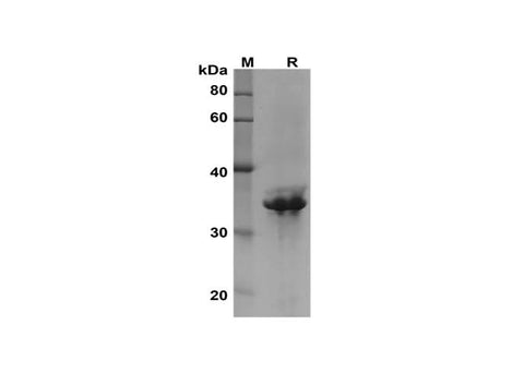 SDS-PAGE analysis of Human MAPK15 proteins, 2 μg/lane of Recombinant Human MAPK15 proteins was resolved with SDS-PAGE under reducing conditions, showing bands at 35 kDa.