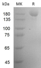 Recombinant SARS-CoV-2 S-trimer(D614G, N439K)(His Tag) - ABMIUM