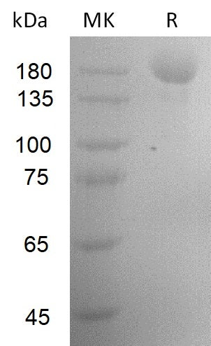 Recombinant SARS-CoV-2 S-trimer(D614G, N439K)(His Tag) - ABMIUM