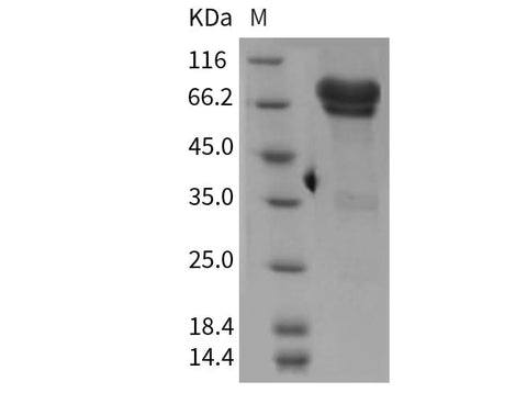 Recombinant Mouse NGFR/CD271 Protein (Fc Tag) - ABMIUM