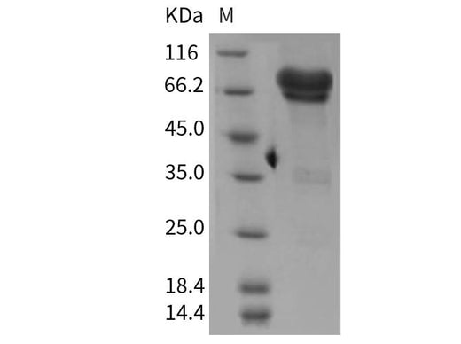 Recombinant Mouse NGFR/CD271 Protein (Fc Tag) - ABMIUM