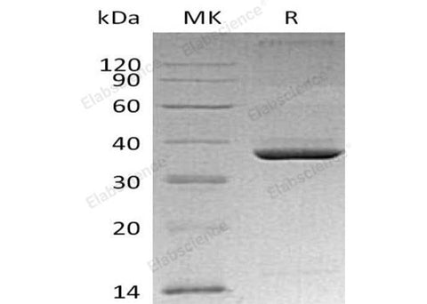 Recombinant Mouse Apolipoprotein E/ApoE Protein (His Tag) - ABMIUM
