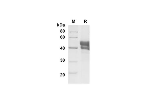 SDS-PAGE analysis of Mouse CD27 Ligand/TNFSF7 proteins , 2 μg/lane of Recombinant Mouse CD27 Ligand/TNFSF7 proteins was resolved with SDS-PAGE under reducing conditions , showing bands at 45 kDa.