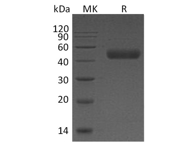 Recombinant Human Galectin 9/LGALS9 Protein (His Tag) - ABMIUM