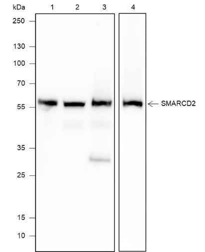 Anti-Human/Rat/Mouse SMARCD2 Antibody [A620]