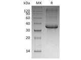 Recombinant Human SP-10/ACRV1 Protein (His Tag) - ABMIUM