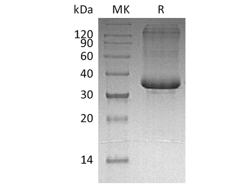 Recombinant Human SP-10/ACRV1 Protein (His Tag) - ABMIUM