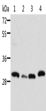 Anti-Human/Mouse STRADB Antibody - ABMIUM