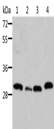 Anti-Human/Mouse STRADB Antibody - ABMIUM