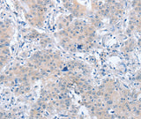 Anti-Human/Mouse/Rat PARD6A Antibody - ABMIUM