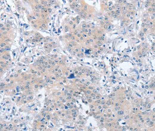 Anti-Human/Mouse/Rat PARD6A Antibody