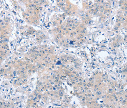 Anti-Human/Mouse/Rat PARD6A Antibody - ABMIUM