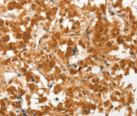 Anti-Human/Mouse COL4A3BP Antibody - ABMIUM