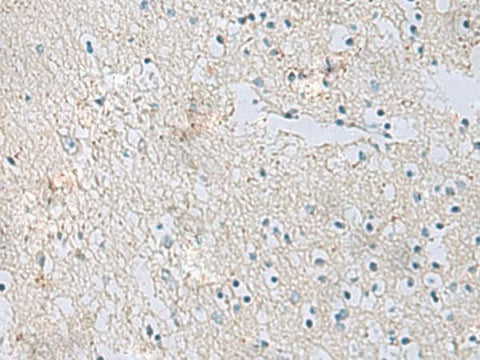 Immunohistochemistry of paraffin-embedded Human brain tissue using RDH5 Polyclonal Antibody at dilution of 1:50(×200)