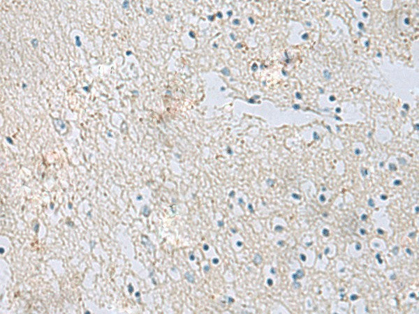Immunohistochemistry of paraffin-embedded Human brain tissue using RDH5 Polyclonal Antibody at dilution of 1:50(×200)