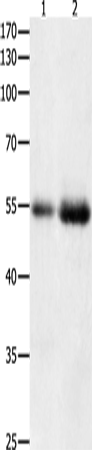 Anti-Human/Mouse/Rat HDAC1 Antibody - ABMIUM