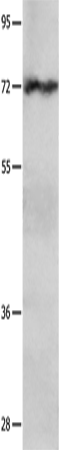 Anti-Human/Mouse/Rat IGF2BP1 Antibody - ABMIUM