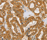 Anti-Human/Mouse/Rat PDP1 Antibody - ABMIUM