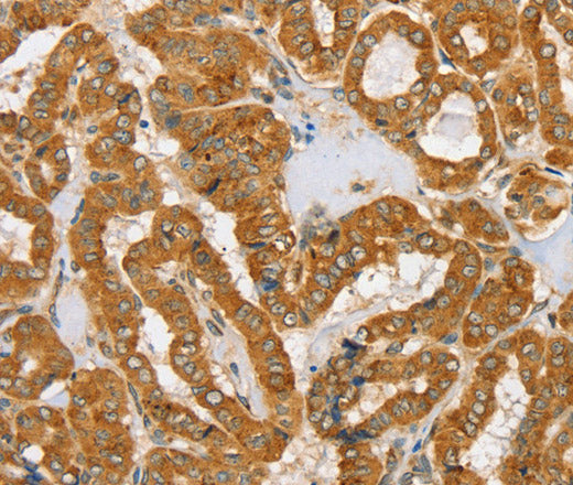 Anti-Human/Mouse/Rat PDP1 Antibody - ABMIUM
