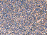 Immunohistochemistry of paraffin-embedded Human tonsil tissue using TNF Polyclonal Antibody at dilution of 1:40(×200)