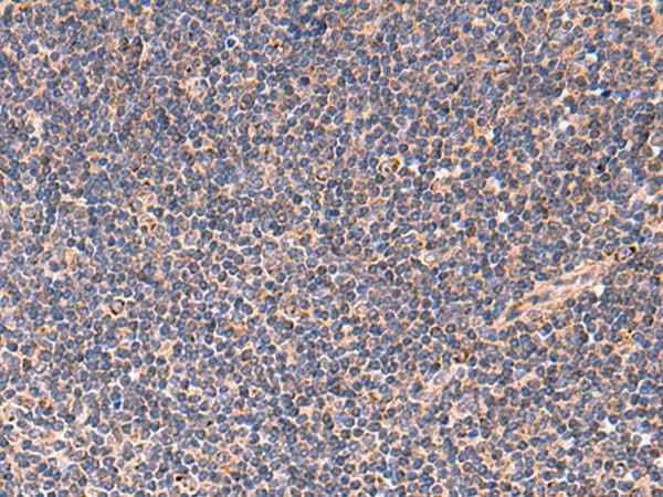 Anti-Human TNF Antibody