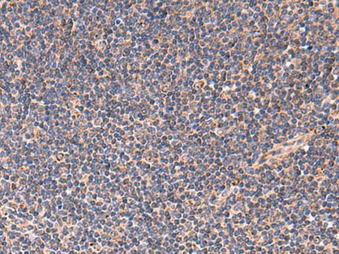 Immunohistochemistry of paraffin-embedded Human tonsil tissue using TNF Polyclonal Antibody at dilution of 1:40(×200)