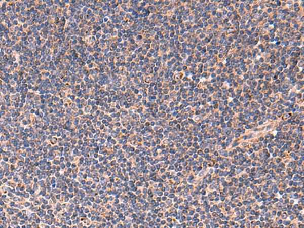 Immunohistochemistry of paraffin-embedded Human tonsil tissue using TNF Polyclonal Antibody at dilution of 1:40(×200)