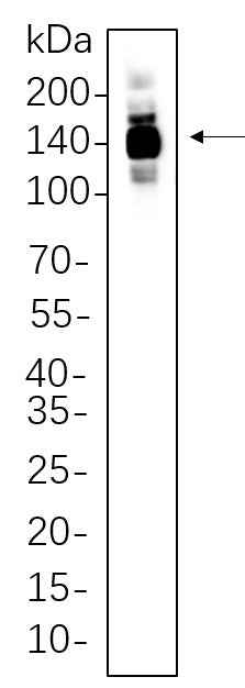 Anti-Human/Mouse/Rat HDAC4 Antibody [B752] - ABMIUM