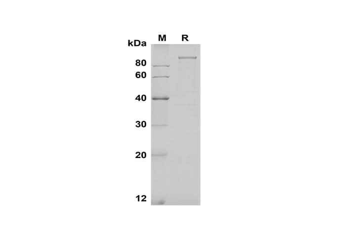 SDS-PAGE analysis of Human GAS6 proteins, 2 μg/lane of Recombinant Human GAS6 proteins was resolved with SDS-PAGE under reducing conditions, showing bands at 100 kDa.