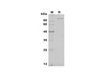 SDS-PAGE analysis of Human GAS6 proteins, 2 μg/lane of Recombinant Human GAS6 proteins was resolved with SDS-PAGE under reducing conditions, showing bands at 100 kDa.