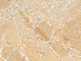 Immunohistochemistry of paraffin-embedded Human brain tissue using TXNDC12 Polyclonal Antibody at dilution of 1:50(×200)