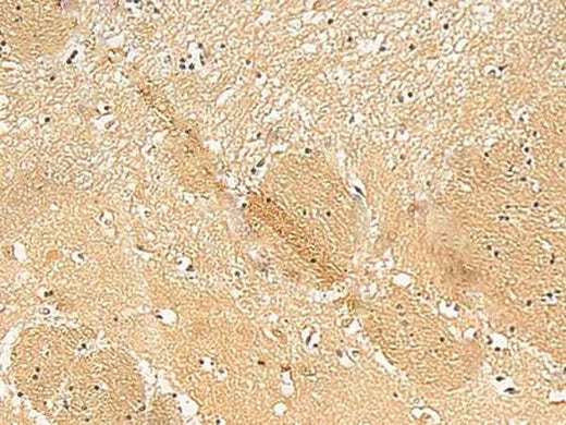 Anti-Human/Mouse/Rat TXNDC12 Antibody