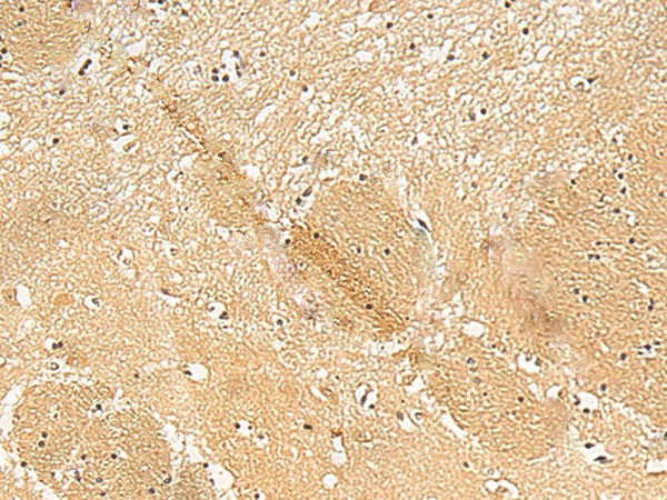 Immunohistochemistry of paraffin-embedded Human brain tissue using TXNDC12 Polyclonal Antibody at dilution of 1:50(×200)