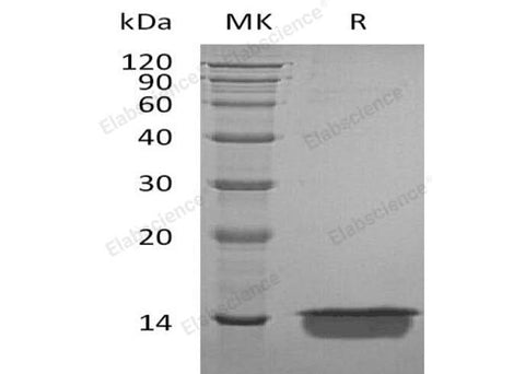 Recombinant Human MIA Protein (His Tag) - ABMIUM