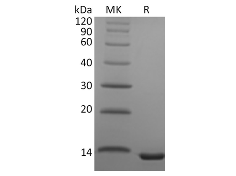 Recombinant Human CCL23 Protein - ABMIUM
