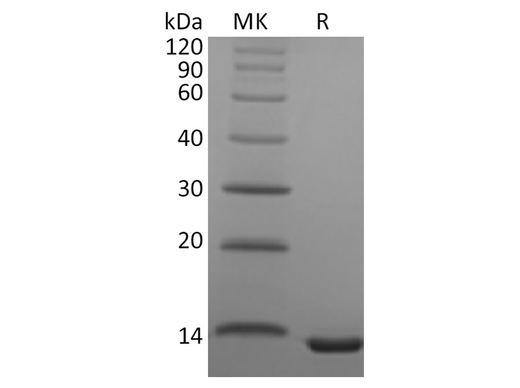 Recombinant Human CCL23 Protein - ABMIUM