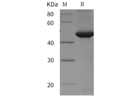 SDS-PAGE analysis of Rat TGF-beta 3/TGFB3 proteins, 2 μg/lane of Recombinant Rat TGF-beta 3/TGFB3 proteins was resolved with SDS-PAGE under reducing conditions, showing bands at 50 kDa.