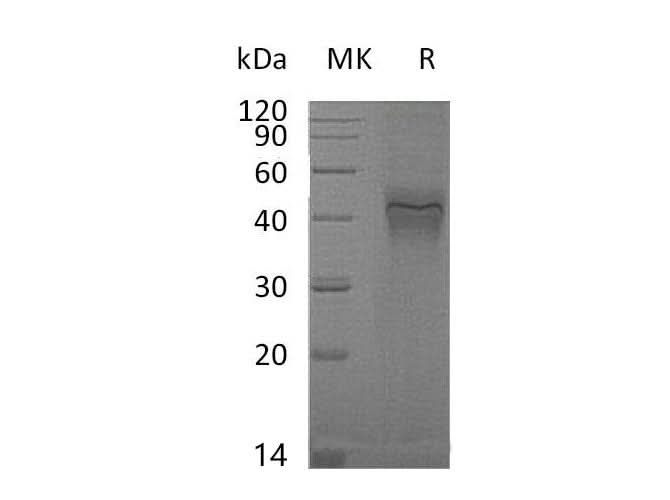 Recombinant Mouse IFNGR1 Protein (His Tag) - ABMIUM