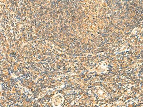 Anti-Human/Mouse LYZL1 Antibody