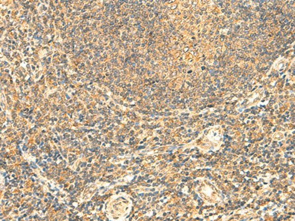 Immunohistochemistry of paraffin-embedded Human tonsil tissue using LYZL1 Polyclonal Antibody at dilution of 1:50(×200)